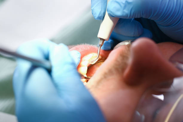 Best Dentist for Tooth Abscess  in Teaticket, MA