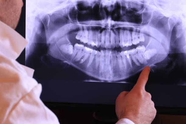 Trusted MA Emergency Dentist Experts